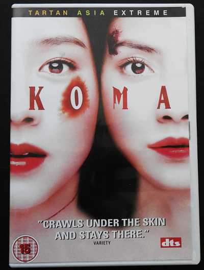 KOMA
